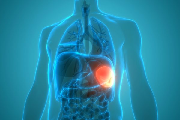 7 Tips Hidup Sehat untuk Orang dengan Gangguan Limpa 7 Tips Hidup Sehat untuk Orang dengan Gangguan Limpa