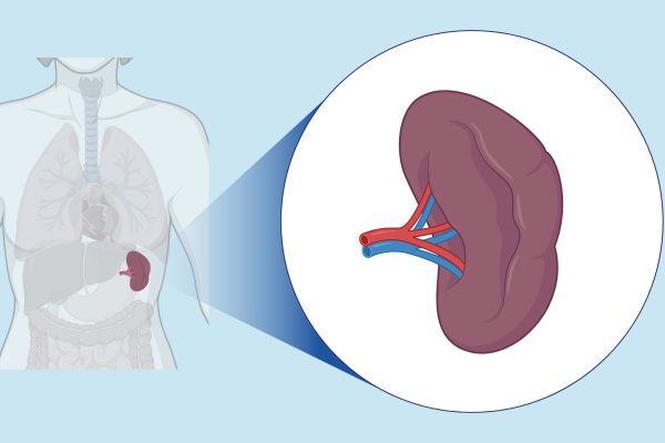 5 Cara Memelihara Limpa Bagi Penderita Anemia 5 Cara Memelihara Limpa Bagi Penderita Anemia