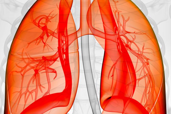 10 Tips Mengatasi Gejala Penyakit Pernapasan Akut 10 Tips Mengatasi Gejala Penyakit Pernapasan Akut