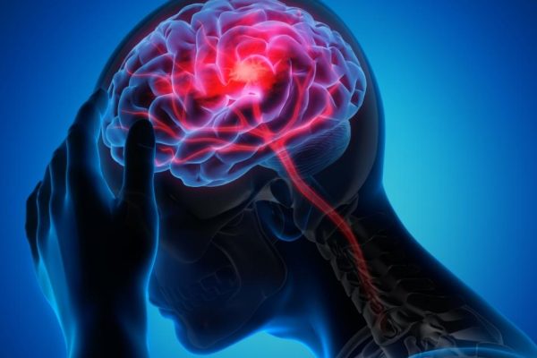 5 Cara Mengurangi Risiko Kanker Otak 5 Cara Mengurangi Risiko Kanker Otak