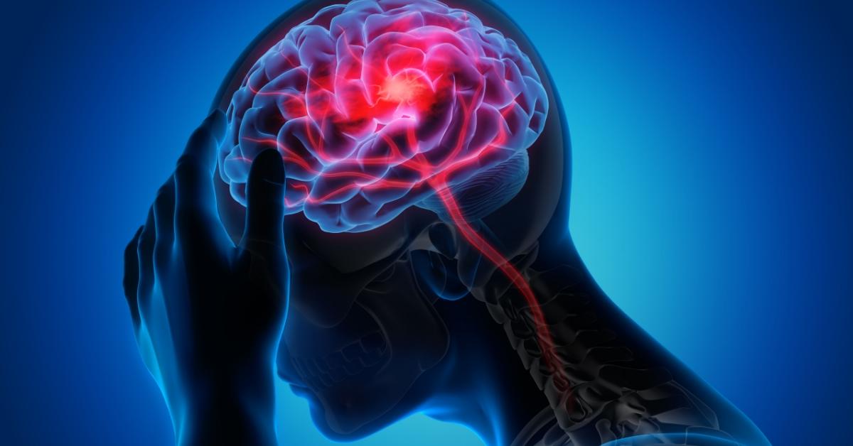 5 Cara Mengurangi Risiko Kanker Otak