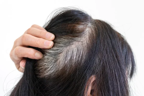 10 Cara Mencegah Rambut Uban Datang Lebih Cepat