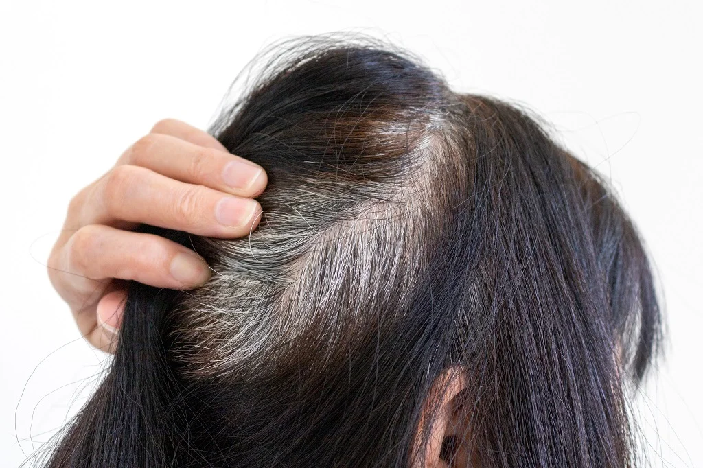 10 Cara Mencegah Rambut Uban Datang Lebih Cepat
