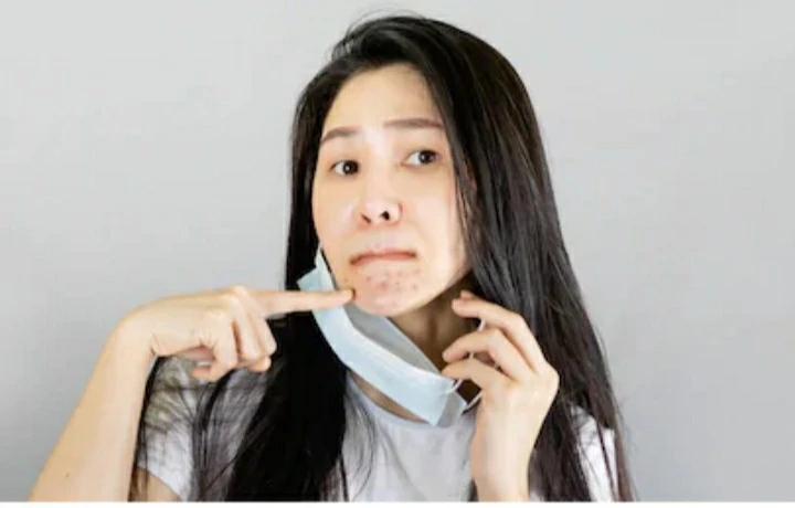7 Solusi untuk Dagu Menghitam Akibat Gesekan Masker