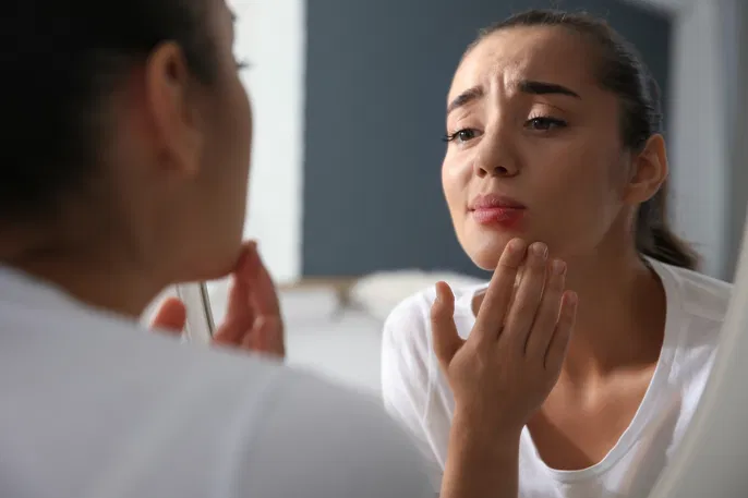 10 Cara Mengatasi Bibir Bengkak Secara Alami